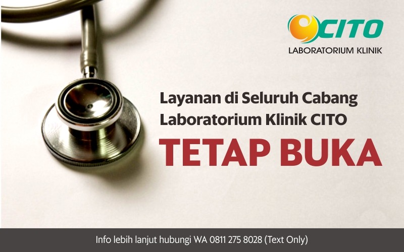 Layanan di Seluruh Cabang Laboratorium Klinik CITO Tetap Buka