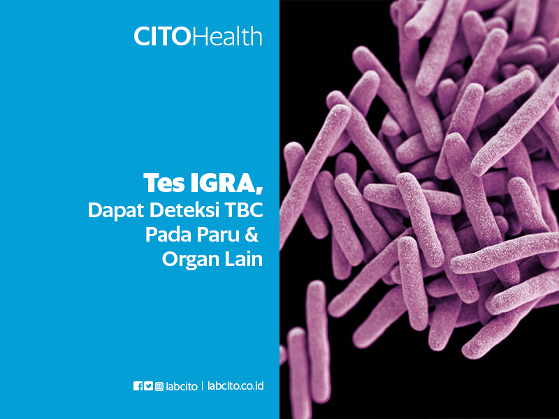 Tes IGRA Untuk Deteksi TBC
