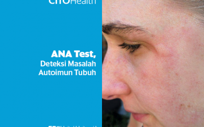 ANA Test (Anti Nuclear Antibody), Deteksi Masalah Autoimun Tubuh