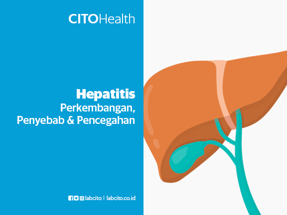 Hepatitis (Perkembangan, Penyebab, dan Pencegahan)