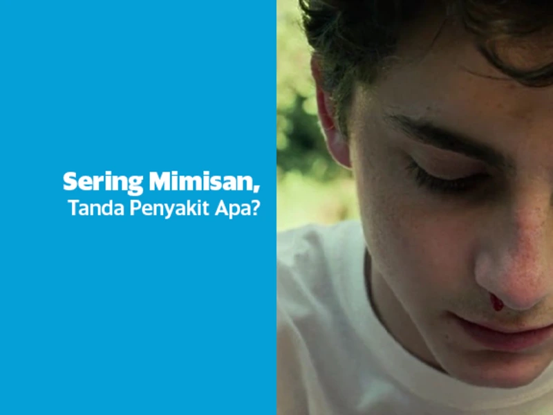 Mimisan Sering Terjadi Secara Mendadak, Tanda Penyakit Apa?