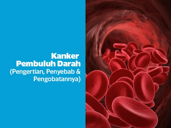 Kanker Pembuluh Darah (Gejala, Penyebab & Pengobatan)