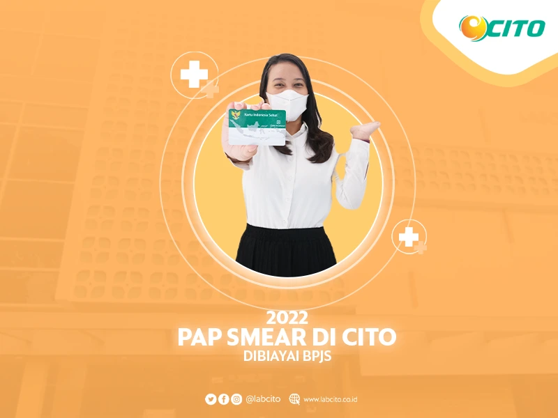 2022, Pap Smear di CITO Dibiayai BPJS Kesehatan