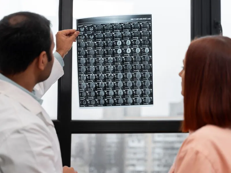 Aneurisme Otak: Ketahui Gejala, Penyebab, dan Metode Pengobatannya